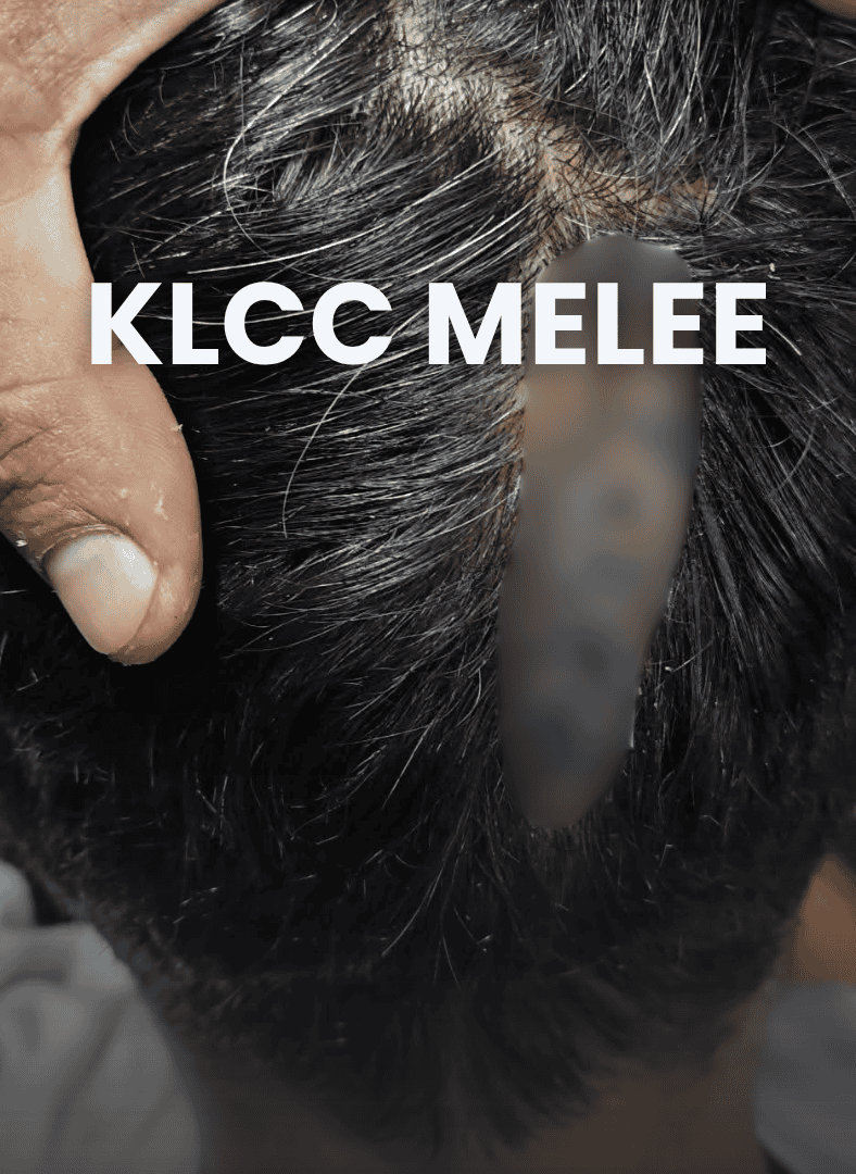 klcc illegal photographer assault march 2026