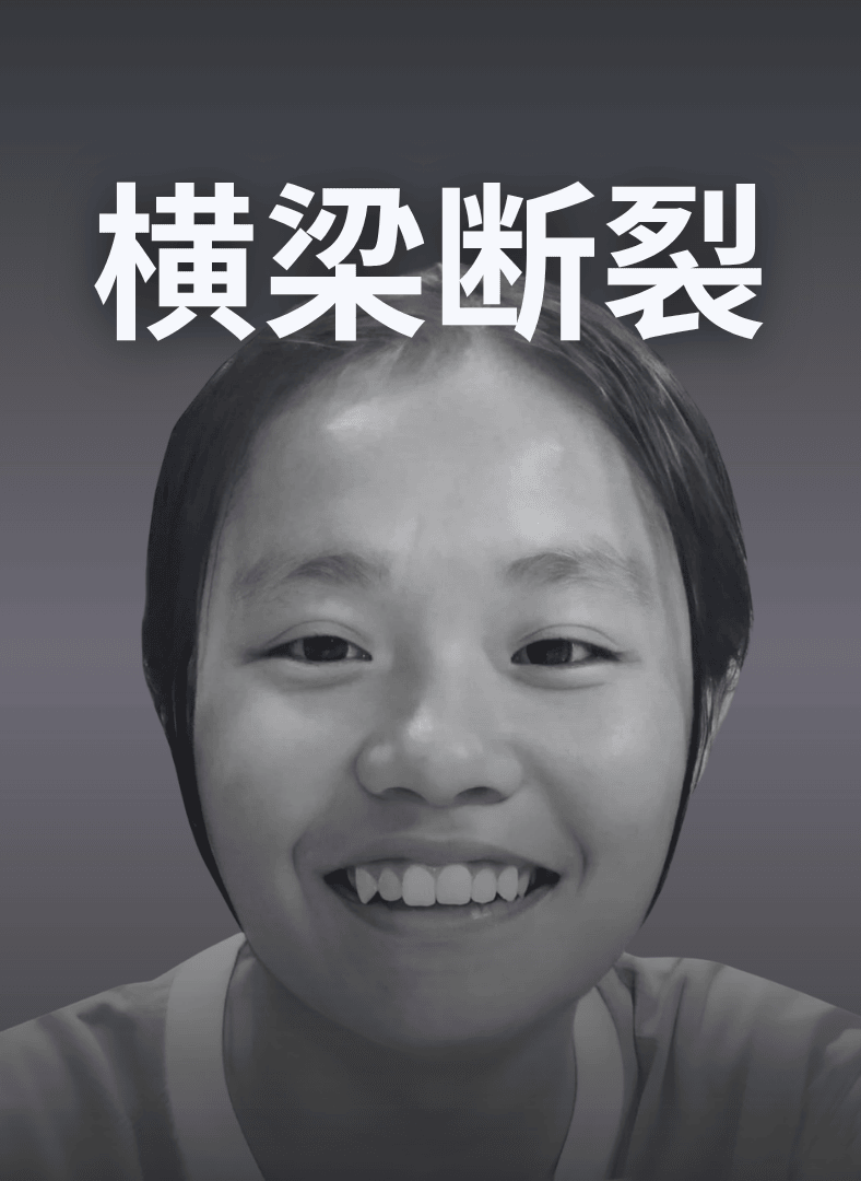 神庙横梁断裂砸死少女