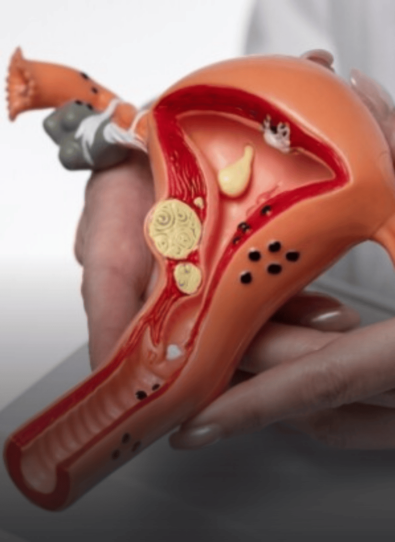 kontroversi sasha abdul aziz buat rawatan ketatkan faraj