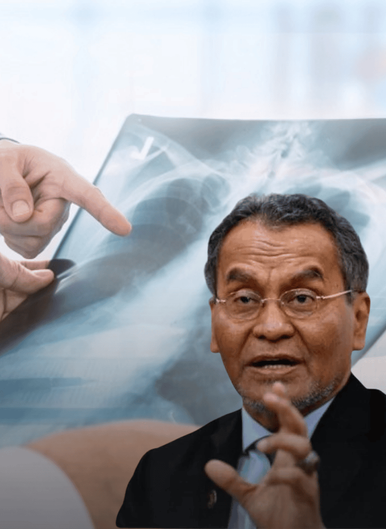 柔佛州哥打丁宜爆发结核病